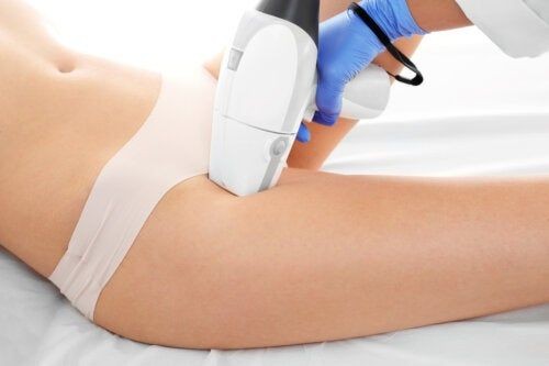 Depilacion laser bikini line ( Dama)